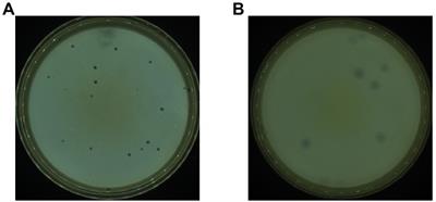 Isolation and characterization of two homolog phages infecting Pseudomonas aeruginosa